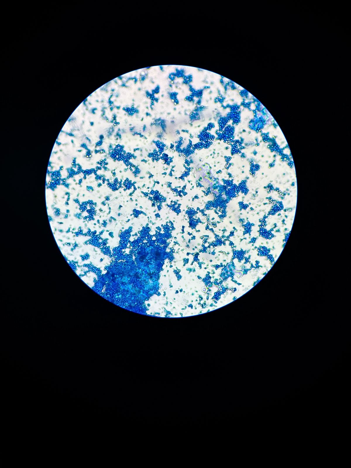 VARIEDAD BOURBON AMARILLO by Wilton Benitez